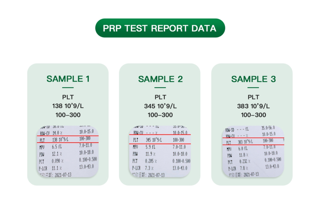 PRP Tube 8ml with Separation Gel
